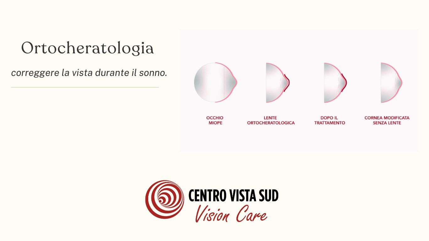 Ortocheratologia: Il Trattamento Notturno che Corregge la Vista.